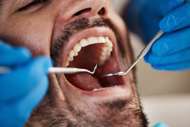 Best Emergency Treatment for Oral Infections in Spring House, PA